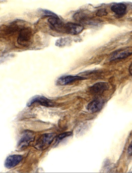 TICAM1 Antibody