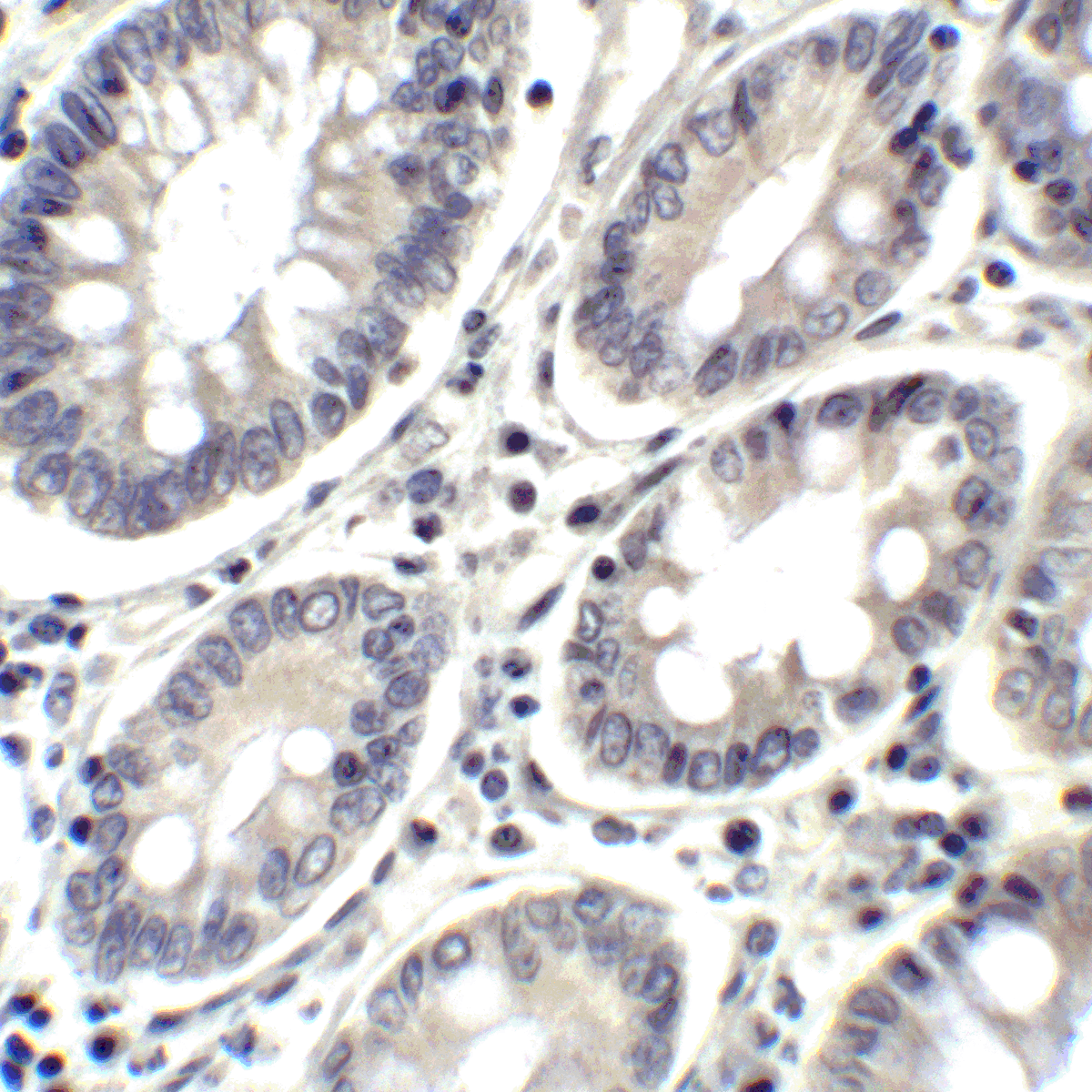 PDCD1LG2 Antibody