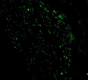 Pmaip1 Antibody