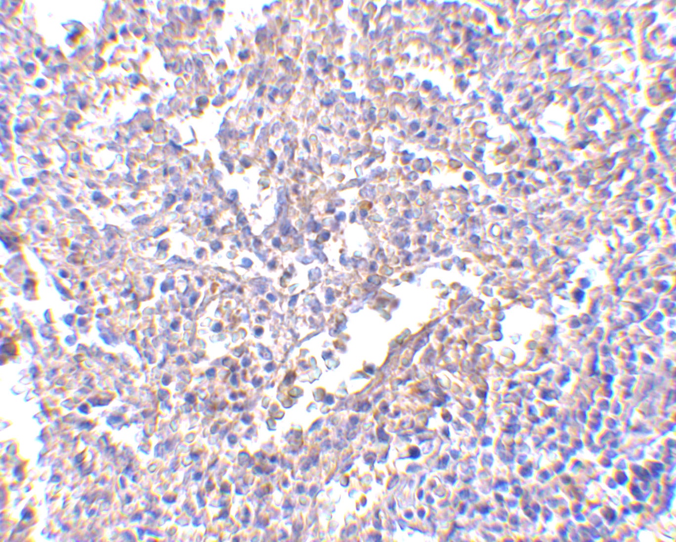 LY96 Antibody