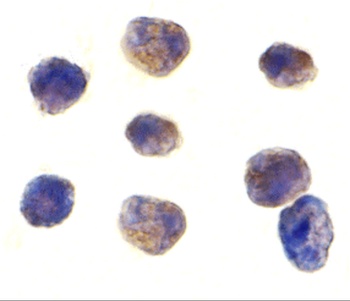 TAB1 Antibody
