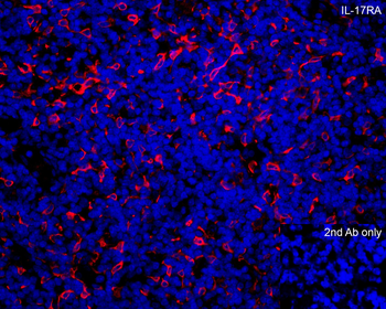 IL17RA Antibody