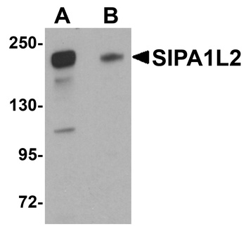 SIPA1L2 Antibody