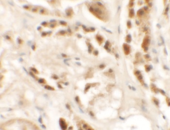 SIGLEC15 Antibody
