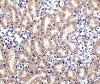 TNFRSF10D Antibody