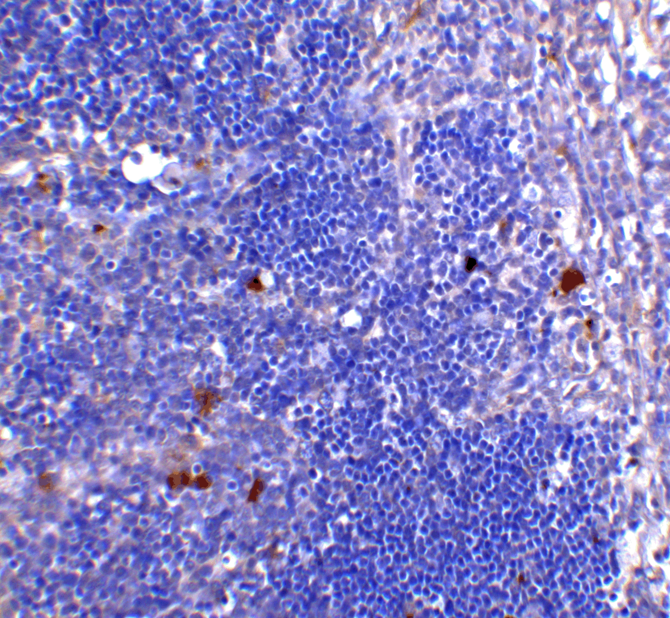 CD4 Antibody