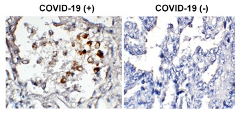 SARS-CoV-2 (COVID-19) Spike Antibody (biotin)