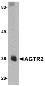 AGTR2 Antibody