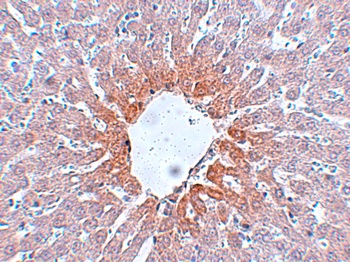 AGTR2 Antibody