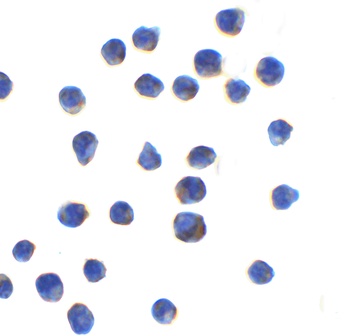 AGTR2 Antibody