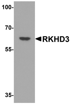 MEX3B Antibody