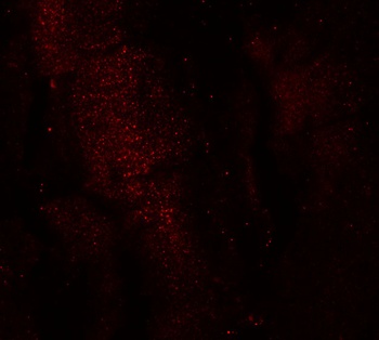 MEX3B Antibody