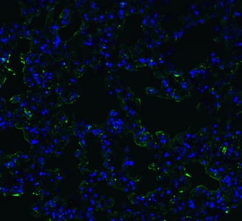 ACE2 Antibody