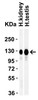 ACE2 Antibody