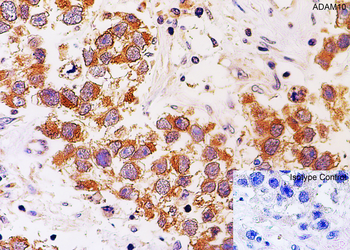 ADAM10 Antibody