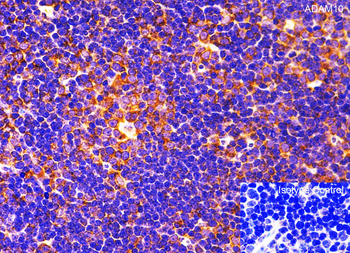 ADAM10 Antibody
