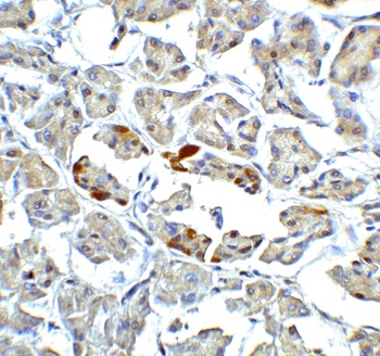 ATF6 Antibody