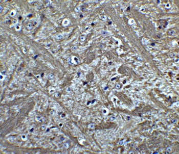 BCL2 Antibody