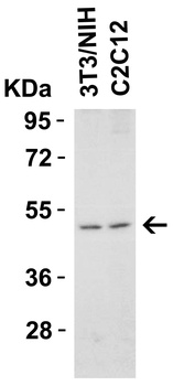 TNFRSF10B Antibody