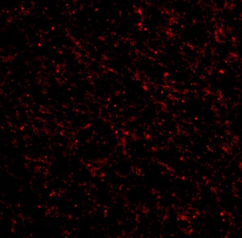 TACR3 Antibody