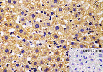 GLS2 Antibody