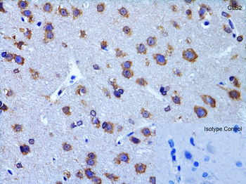 GLS2 Antibody