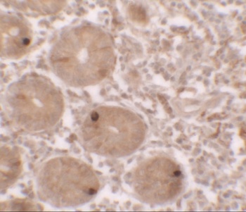 MTERFD2 Antibody