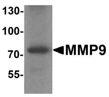 MMP9 Antibody