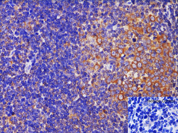 IL21 Antibody