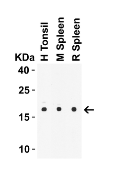 IL21 Antibody