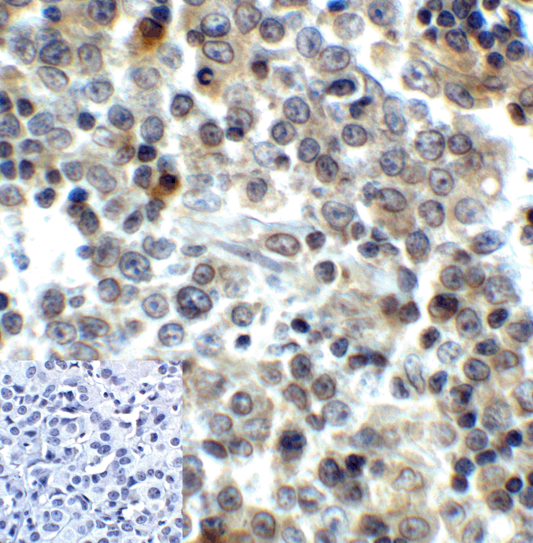 LAG3 Antibody
