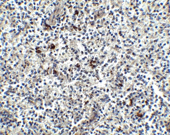 LY96 Antibody