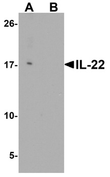 IL22 Antibody