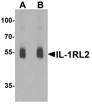 IL1RL2 Antibody