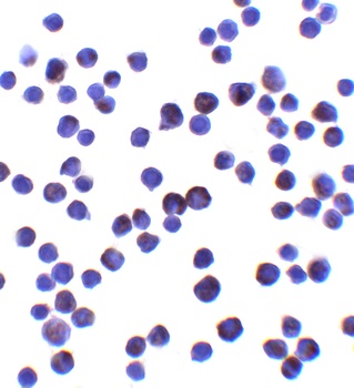 IL-11 Antibody
