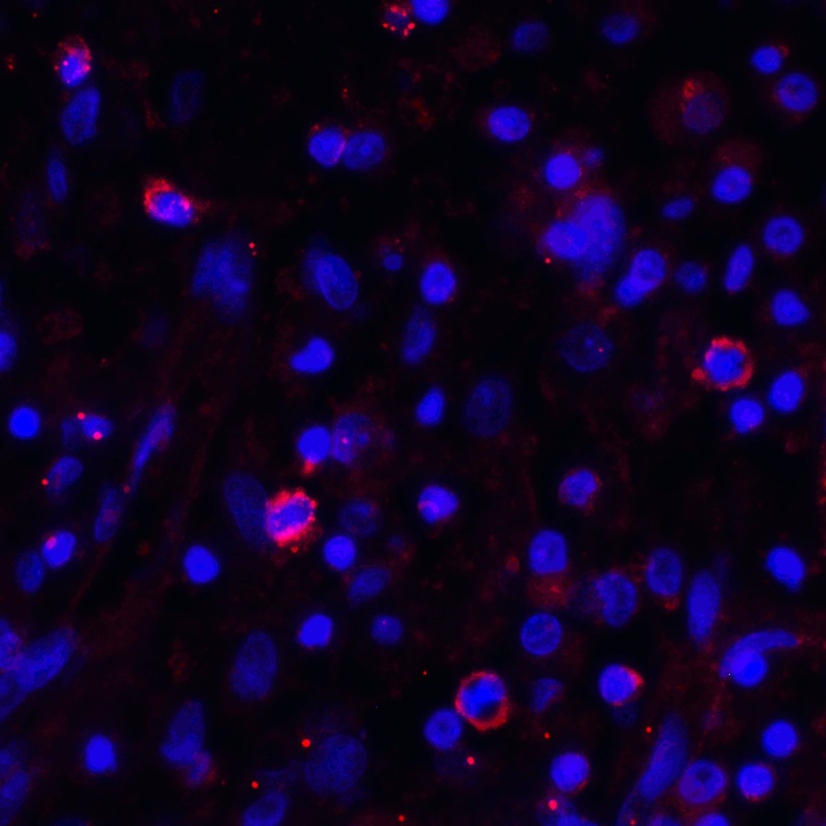 CD274 Antibody