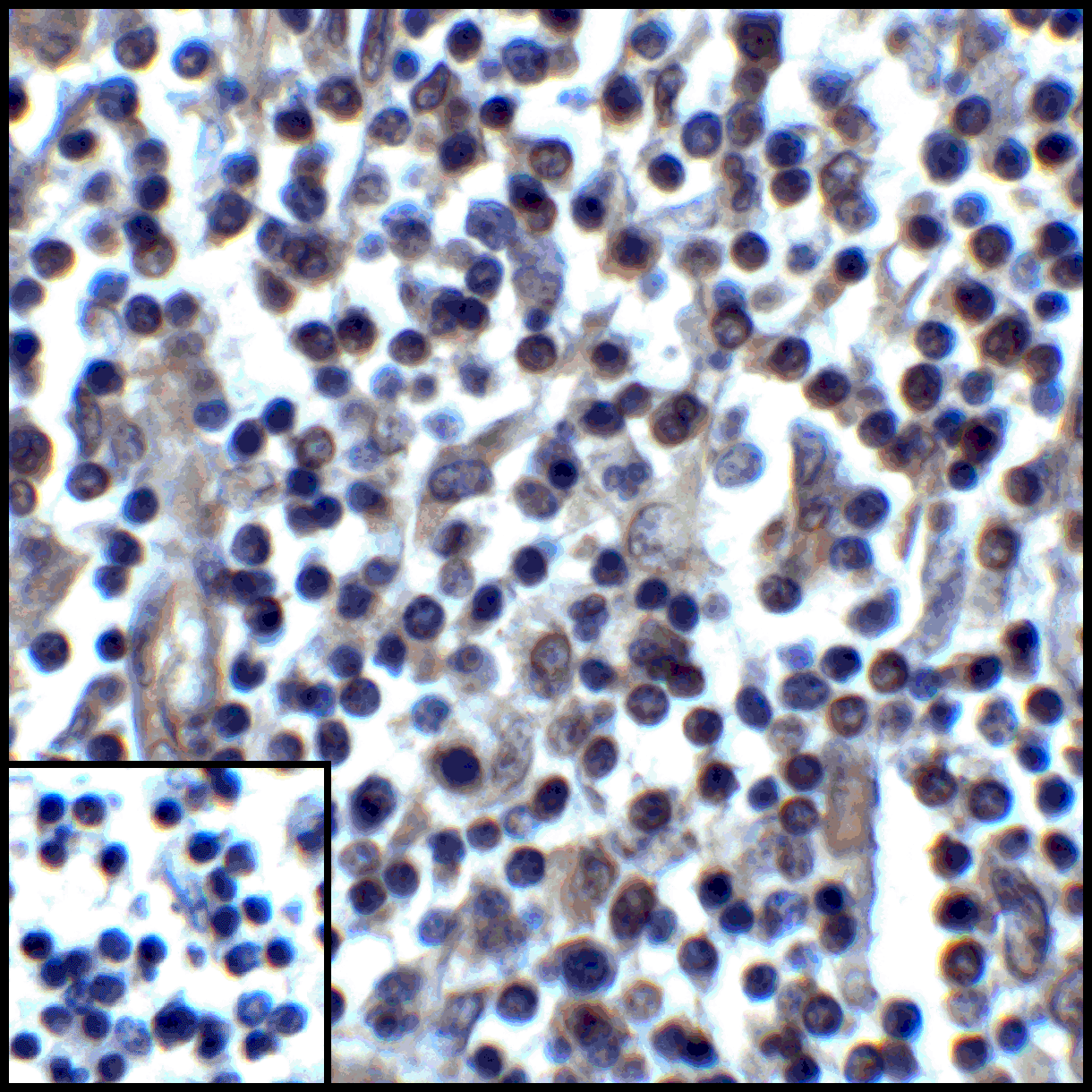 CD274 Antibody