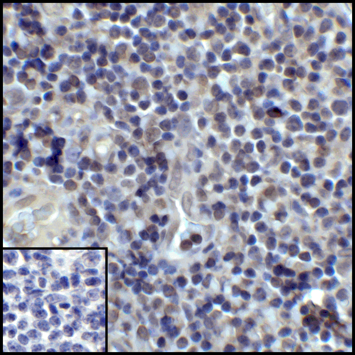 CD274 Antibody