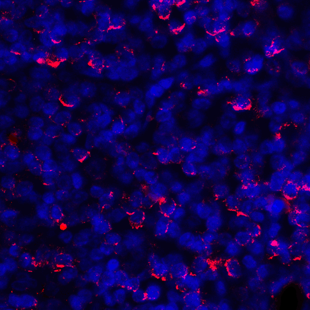 CD274 Antibody