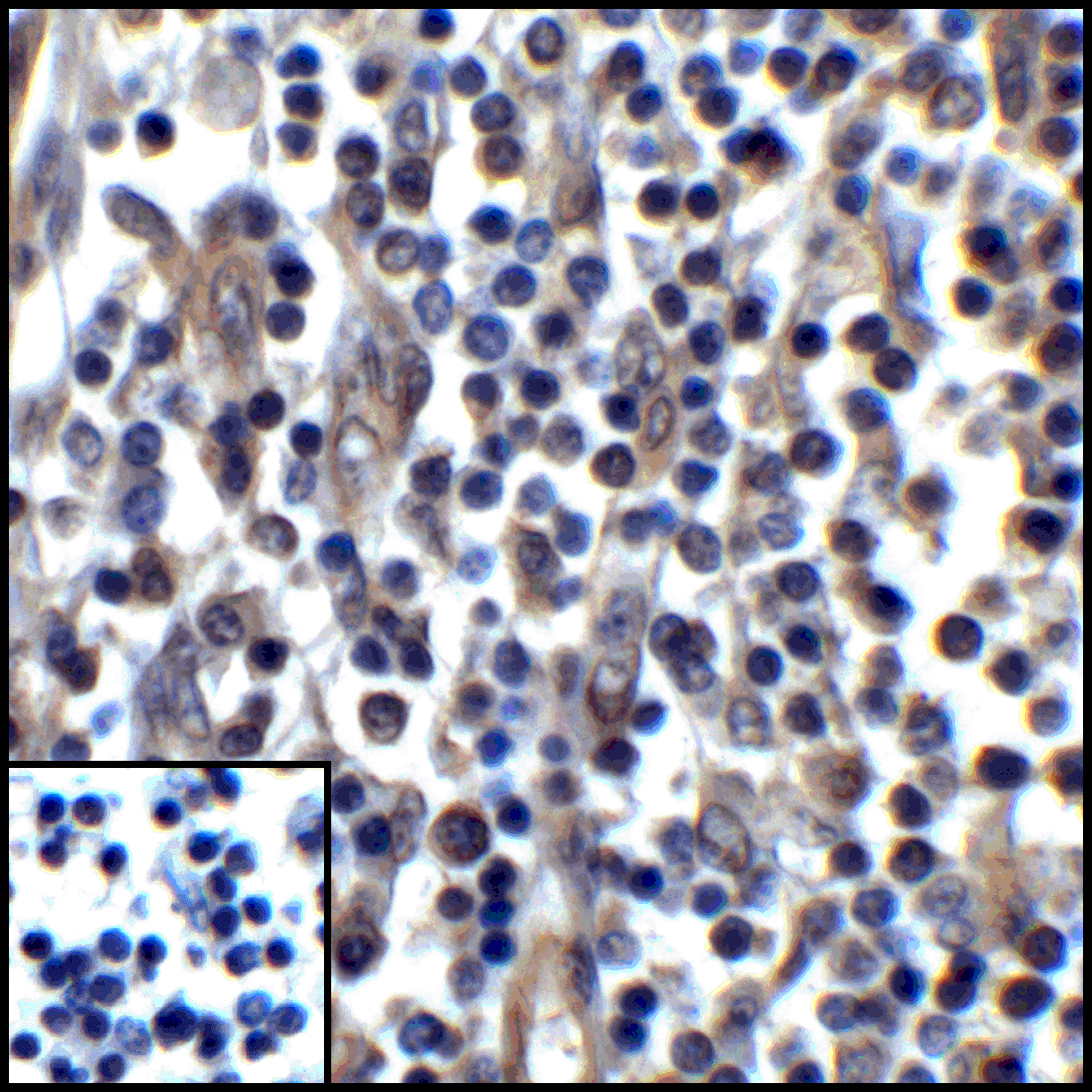 CD274 Antibody