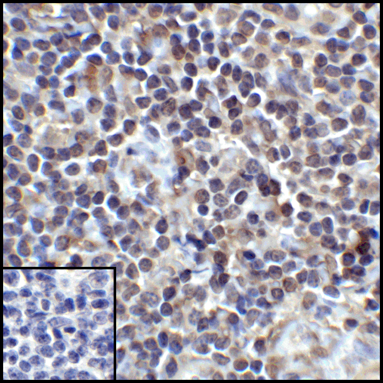 CD274 Antibody