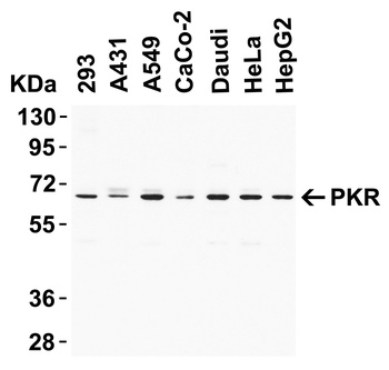 EIF2AK2 Antibody