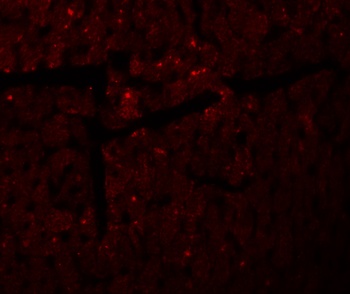 DDA1 Antibody