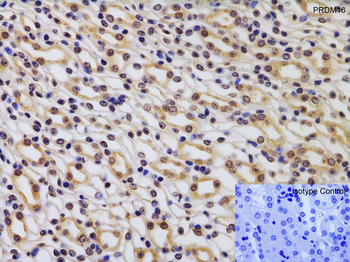PRDM16 Antibody