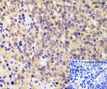 PRDM16 Antibody