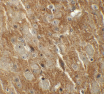 CTNNBL1 Antibody