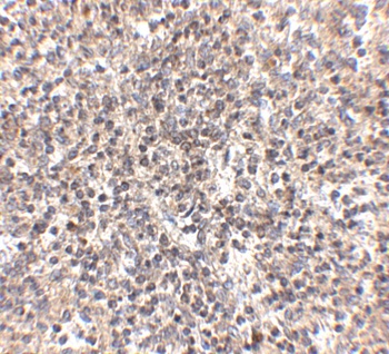 RSPO1 Antibody