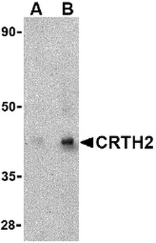 PTGDR2 Antibody