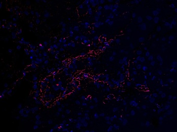 SARS-CoV-2 (COVID-19) Envelope Antibody