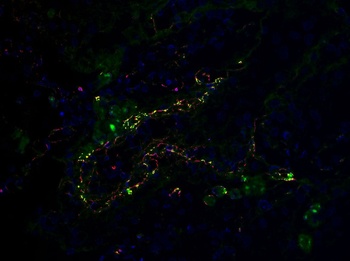 SARS-CoV-2 (COVID-19) Envelope Antibody